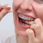 Orthodontist in Fulham